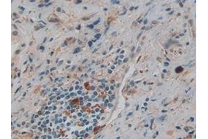 Immunohistochemistry (IHC) image for anti-Gelsolin (GSN) (AA 577-771) antibody (ABIN7442030)