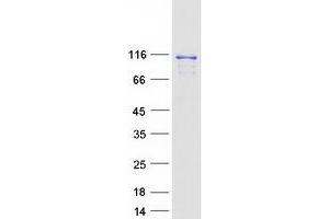 Validation with Western Blot (RAI14 Protein (Transcript Variant 1) (Myc-DYKDDDDK Tag))