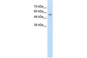 Image no. 1 for anti-ATP-Binding Cassette, Sub-Family D (Ald), Member 4 (ABCD4) (AA 451-500) antibody (ABIN396878) (ABCD4 Antikörper  (AA 451-500))