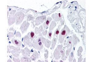 Anti-HDAC2 antibody IHC of human heart. (HDAC2 Antikörper  (AA 419-468))