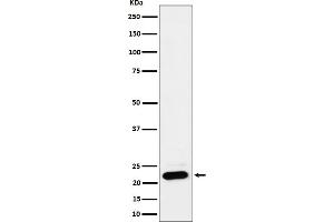 Western blot analysis of NDUFB9 expression in HEK293 cell lysate.