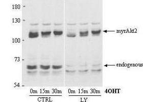 Western Blot of Rabbit Anti-AKT2 antibody. (AKT2 Antikörper  (AA 455-468))