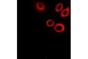 Immunofluorescence (IF) image for anti-serpin Peptidase Inhibitor, Clade B (Ovalbumin), Member 1 (SERPINB1) antibody (ABIN7306502)