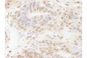 anti-Polymerase (DNA-Directed), delta 3, Accessory Subunit (POLD3) (AA 325-375) antibody