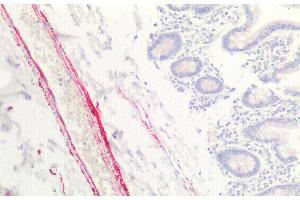 Detection of COL8a1 in Human Small intestine Tissue using Polyclonal Antibody to Collagen Type VIII Alpha 1 (COL8a1) (COL8A1 Antikörper  (AA 583-743))