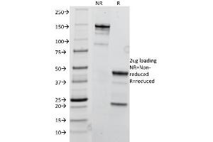SDS-PAGE Analysis Purified TRIM29 Mouse Monoclonal Antibody (TRIM29/1041). (TRIM29 Antikörper  (AA 1-200))