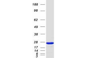 Western Blotting (WB) image for RAB6B, Member RAS Oncogene Family (RAB6B) protein (Myc-DYKDDDDK Tag) (ABIN2730365)