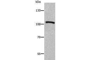 Western Blotting (WB) image for anti-ADAM Metallopeptidase with thrombospondin Type 1 Motif, 5 (ADAMTS5) antibody (ABIN2425574) (ADAMTS5 Antikörper)