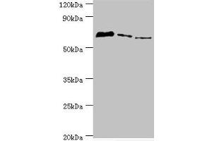 Western blot All lanes: Tyrosyl-DNA phosphodiesterase 1 antibody at 8 μg/mL Lane 1: MCF-7 whole cell lysate Lane 2: Mouse lung tissue Lane 3: Rat brain tissue Secondary Goat polyclonal to rabbit IgG at 1/10000 dilution Predicted band size: 69, 42 kDa Observed band size: 69 kDa (TDP1 Antikörper  (AA 1-260))