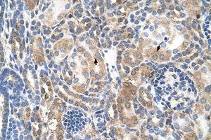 Image no. 1 for anti-Nuclear Receptor Subfamily 3, Group C, Member 2 (NR3C2) (AA 651-700) antibody (ABIN205082)