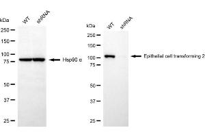 Western blotting analysis using epithelial cell transforming 2 antibody (ABIN7798482). (ECT2 Antikörper)