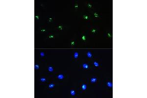 Immunofluorescence analysis of H9C2 cells using NOP58 Rabbit pAb (ABIN1681073, ABIN3019190, ABIN3019191 and ABIN6220753) at dilution of 1:100. (NOP58 Antikörper  (AA 360-529))