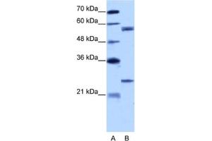 Western Blotting (WB) image for anti-Copine I (CPNE1) antibody (ABIN2462160) (CPNE1 Antikörper)