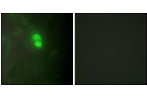 Immunofluorescence analysis of HeLa cells, using Dyskerin antibody. (DKC1 Antikörper  (Internal Region))