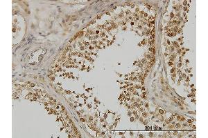 Immunoperoxidase of monoclonal antibody to DDX3Y on formalin-fixed paraffin-embedded human testis. (DDX3Y Antikörper  (AA 1-80))