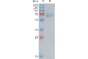 SDS-PAGE (SDS) image for EPH Receptor A2 (EPHA2) (AA 26-535) protein (His tag) (ABIN7538224)