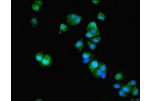 Immunofluorescent analysis of MCF-7 cells using ABIN7143067 at dilution of 1:100 and Alexa Fluor 488-congugated AffiniPure Goat Anti-Rabbit IgG(H+L) (ACTL9 Antikörper  (AA 1-160))