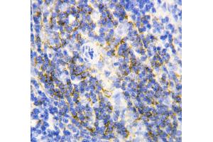 Anti-Annexin VI antibody, IHC(P) IHC(P): Rat Spleen Tissue (ANXA6 Antikörper  (C-Term))