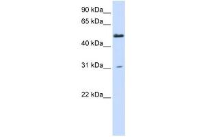 Western Blotting (WB) image for anti-Alanine-Glyoxylate Aminotransferase 2-Like 2 (AGXT2L2) antibody (ABIN2459140)