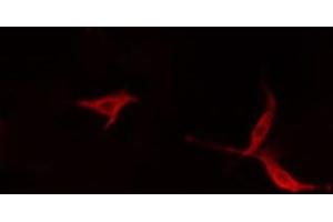ABIN6279568 staining HepG2 cells by IF/ICC. (Myosin XVI Antikörper  (Internal Region))