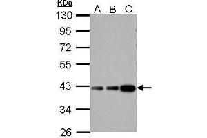 Western Blotting (WB) image for anti-Aldolase B, Fructose-Bisphosphate (ALDOB) antibody (ABIN2855024)