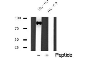 Western blot analysis of extracts of HL-60 cells, using IFT88 antibody. (IFT88 Antikörper  (C-Term))