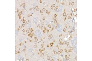 anti-Ribosomal Protein L26-Like 1 (RPL26L1) antibody