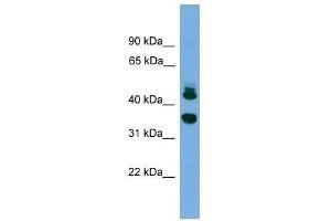 FLJ30934 antibody used at 0. (FLJ30934 (Middle Region) Antikörper)