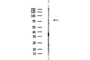 Western blot analysis of lysates from COLO205 cells(LPS,4h treatment), using PKC theta Antibody at 1/1000 dilution.