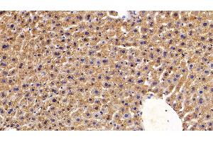 Immunohistochemistry (IHC) image for anti-R-Spondin 1 (RSPO1) (AA 21-135) antibody (ABIN7430144)