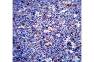 MMP3 antibody immunohistochemistry analysis in formalin fixed and paraffin embedded human tonsil tissue. (MMP3 Antikörper  (AA 30-59))