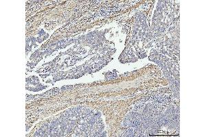 IHC analysis of MT-ND5 using anti-MT-ND5 antibody (ABIN7600145). (MT-ND5 Antikörper  (AA 154-570))