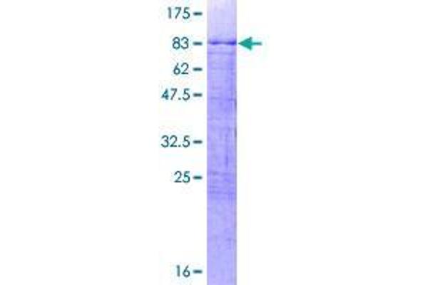 CBX6 Protein (AA 1-412) (GST tag)