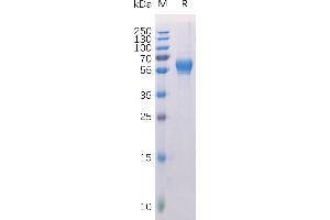 SDS-PAGE (SDS) image for Receptor Tyrosine Kinase-Like Orphan Receptor 1 (ROR1) (AA 30-403) protein (His tag) (ABIN6964103)