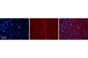 Rabbit Anti-KAT5 Antibody Catalog Number: ARP33345_P050 Formalin Fixed Paraffin Embedded Tissue: Human heart Tissue Observed Staining: Plasma membrane Primary Antibody Concentration: 1:100 Other Working Concentrations: 1:600 Secondary Antibody: Donkey anti-Rabbit-Cy3 Secondary Antibody Concentration: 1:200 Magnification: 20X Exposure Time: 0. (KAT5 Antikörper  (Middle Region))