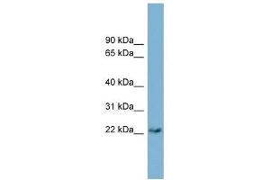 PERP antibody used at 1 ug/ml to detect target protein. (PERP Antikörper  (Middle Region))