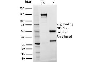 SDS-PAGE Analysis Purified SPASTIN Mouse Monoclonal Antibody (Sp 3G11-1). (Spastin Antikörper)