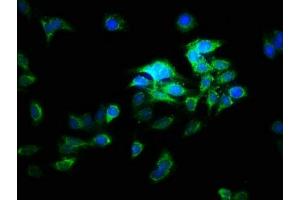 Immunofluorescence staining of HepG2 cells with ABIN7175254 at 1:166, counter-stained with DAPI. (ATP6V1E2 Antikörper  (AA 1-226))