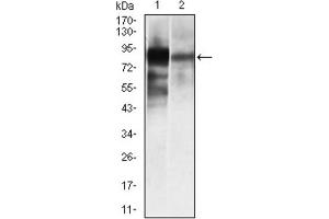 Western blot analysis using ALPL antibody against HeLa (1), and NTERA-2 (4) cell lysate. (ALPL Antikörper)