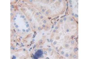 Used in DAB staining on fromalin fixed paraffin- embedded Kidney tissue (RYK Antikörper  (AA 308-570))