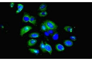 Immunofluorescent analysis of HepG2 cells using ABIN7156675 at dilution of 1:100 and Alexa Fluor 488-congugated AffiniPure Goat Anti-Rabbit IgG(H+L) (IFIT5 Antikörper  (AA 107-320))