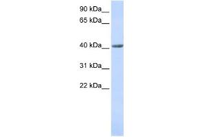 WB Suggested Anti-SMYD3 Antibody Titration:  0. (SMYD3 Antikörper  (N-Term))