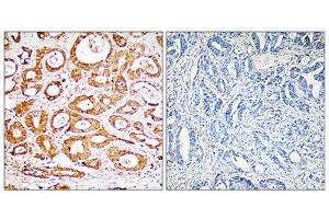 Immunohistochemistry (IHC) image for anti-Ribosomal Protein S19 (RPS19) (Internal Region) antibody (ABIN1850576) (RPS19 Antikörper  (Internal Region))