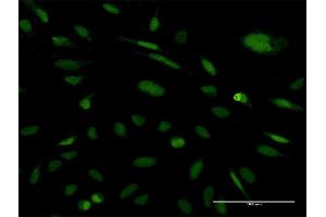 Immunofluorescence of monoclonal antibody to EXOSC5 on HeLa cell. (EXOSC5 Antikörper  (AA 1-235))