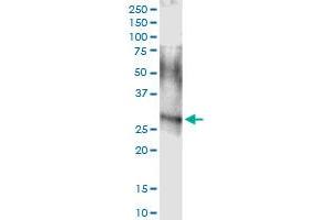 Immunoprecipitation of ARHGDIA transfected lysate using anti-ARHGDIA MaxPab rabbit polyclonal antibody and Protein A Magnetic Bead , and immunoblotted with ARHGDIA MaxPab mouse polyclonal antibody (B01) . (ARHGDIA Antikörper  (AA 1-204))