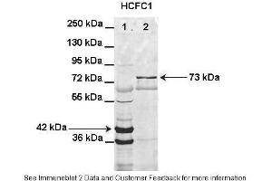 Lanes:   Lane1: HIS-HCFC1 16-363aa (42kD) transformed bacteria lysate Lane2: GFP-HCFC1 363-2002aa (73kD) transformed bacteria lysate elution sample  Primary Antibody Dilution:   1:1000  Secondary Antibody:   Anti-rabbit AlexaFluor 680  Secondary Antibody Dilution:   1:10000  Gene Name:   HCFC1  Submitted by:   Anonymous (HCFC1 Antikörper  (N-Term))