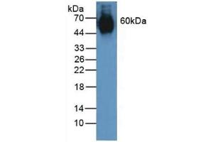 Detection of ELN in Human Lung Tissue using Polyclonal Antibody to Elastin (ELN) (Elastin Antikörper  (AA 392-645))