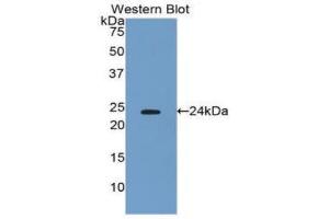Western blot analysis of the recombinant protein. (IFNB1 Antikörper  (AA 22-186))
