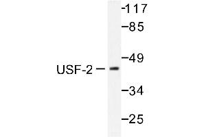 Image no. 1 for anti-Upstream Transcription Factor 2, C-Fos Interacting (USF2) antibody (ABIN271975) (USF2 Antikörper)