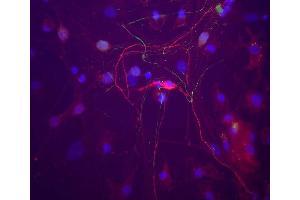 A neuron in a rat cortical neuron culture which stains strongly for peripherin with ABIN1580457 (red). (Peripherin Antikörper)
